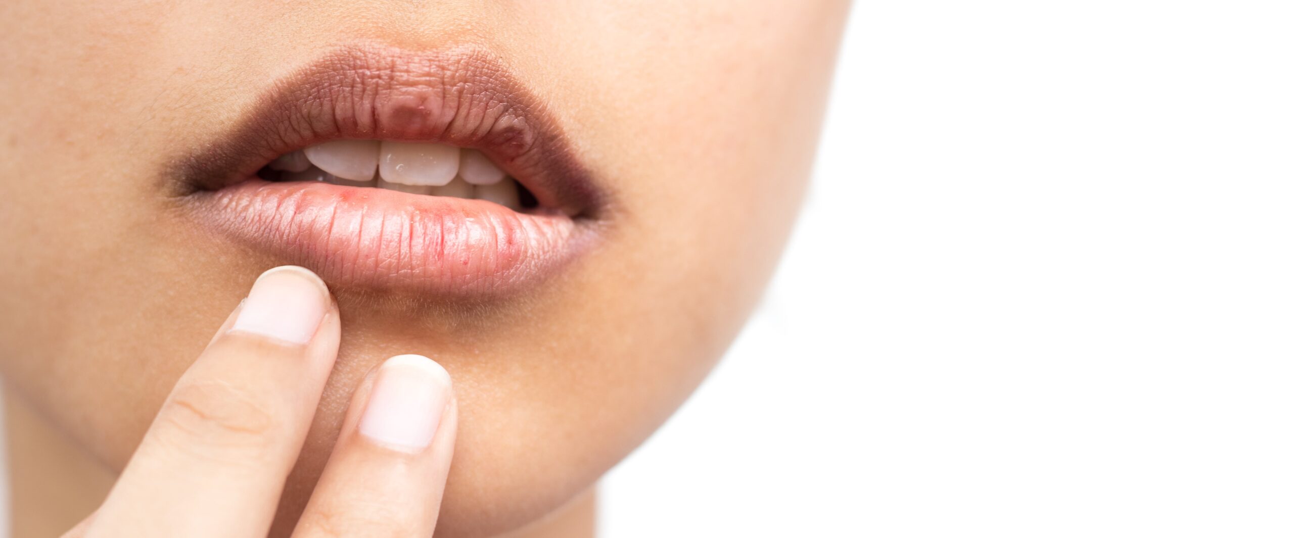 ¿por Qué Se Resecan Los Labios Blen Sabiduría Herbalemk 4810